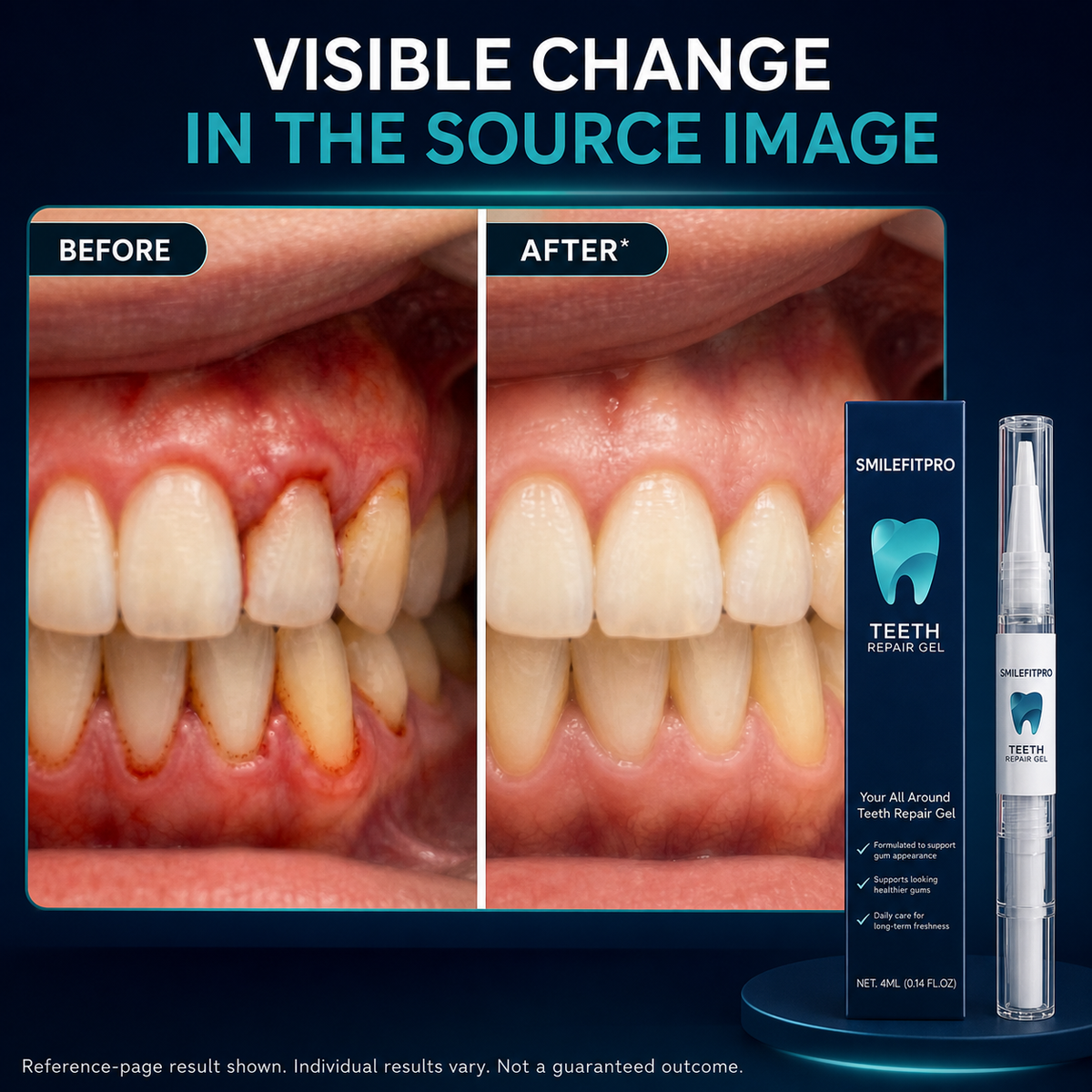 Reference-page before and after gum appearance comparison with individual-results disclosure