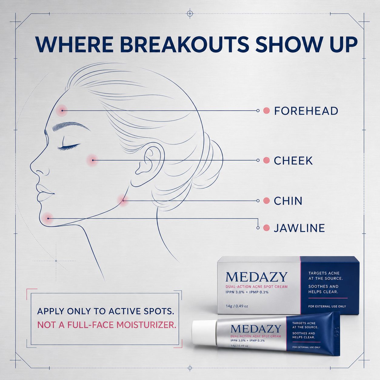 Targeted breakout-zone guide for forehead cheek chin and jawline