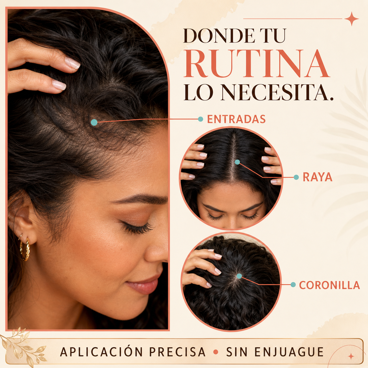 Zonas de aplicación en la raya línea frontal y coronilla