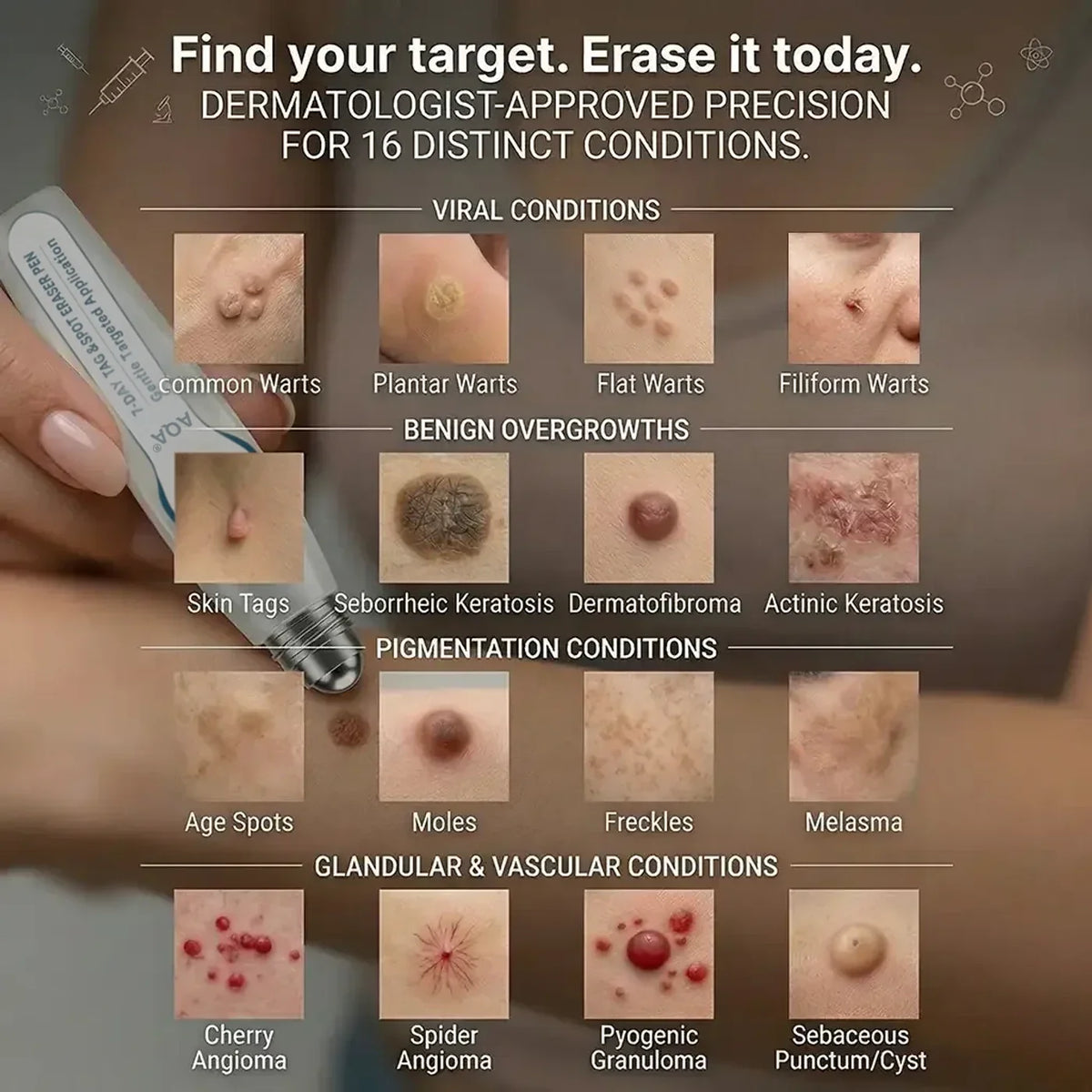 Reference guide to common small raised-looking and pigmented-looking skin areas