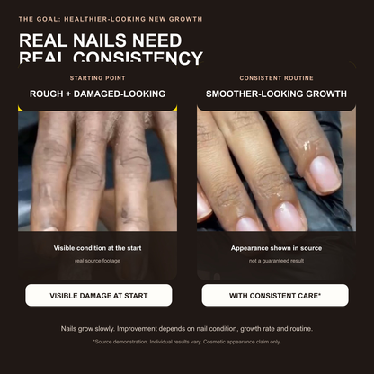 Real source nail appearance demonstration with cosmetic results disclaimer