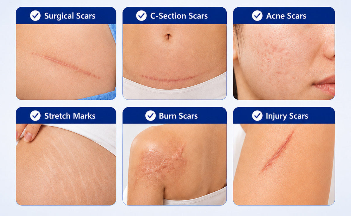 Six types of healed scars supported by daily appearance care