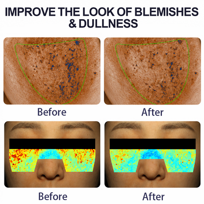 Reference-page visible blemish and dullness comparison