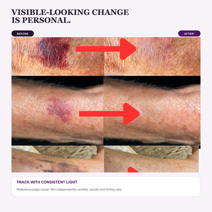 Reference-page before and after appearance comparison with results disclaimer