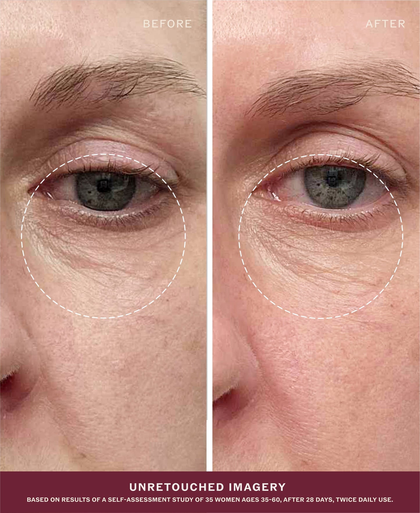 Unretouched source-page under-eye before and after comparison