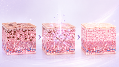 Comfort-first approach to consistent dark spot care