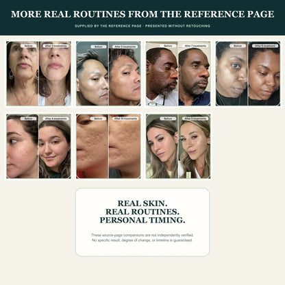 Reference-page supplied PDRN customer comparisons eight through fourteen