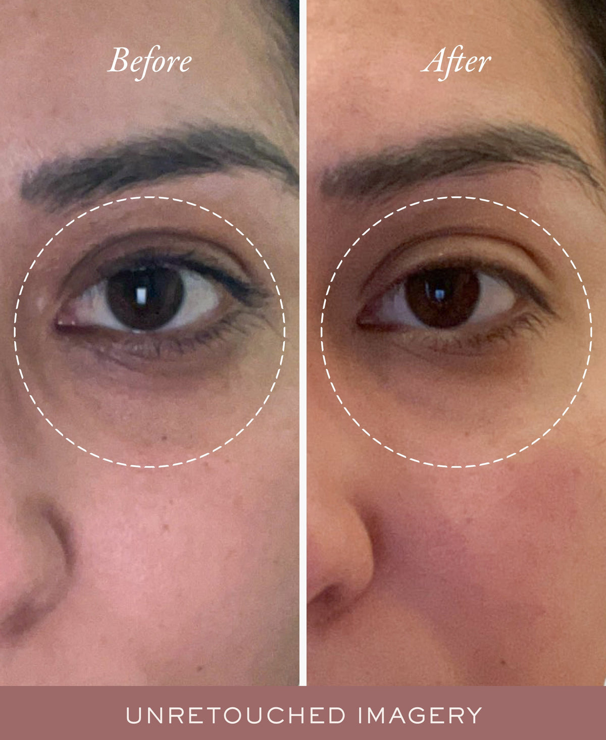 Second unretouched source-page eye-area before and after comparison
