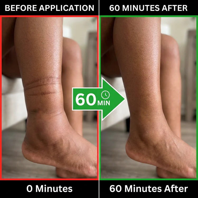 BBOJI® Lymphatic Flush Oil Spray 20 2dba5e8d 7dff 44ab b8d5 14c070504e9f