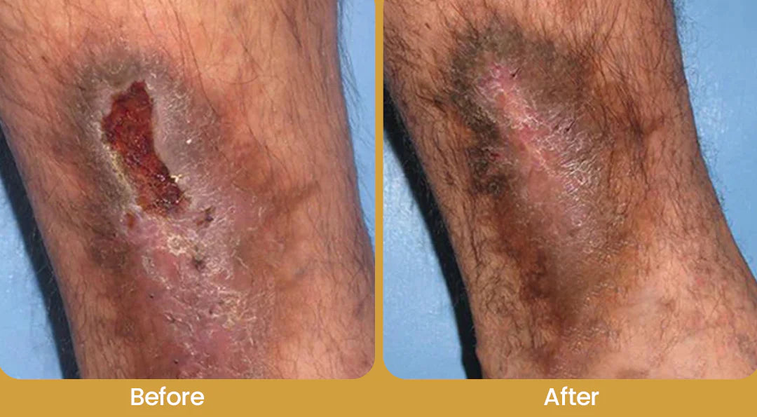 BBOJI® GlucaVeil Foot Shield Spray 18 33 4693be5f f33b 40fb a8fb 1ed4d544c990