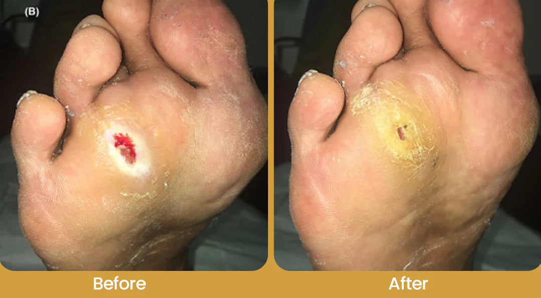 BBOJI® GlucaVeil Foot Shield Spray 17 33 7e0bd953 85d8 4eee b6f1 207c39f824eb