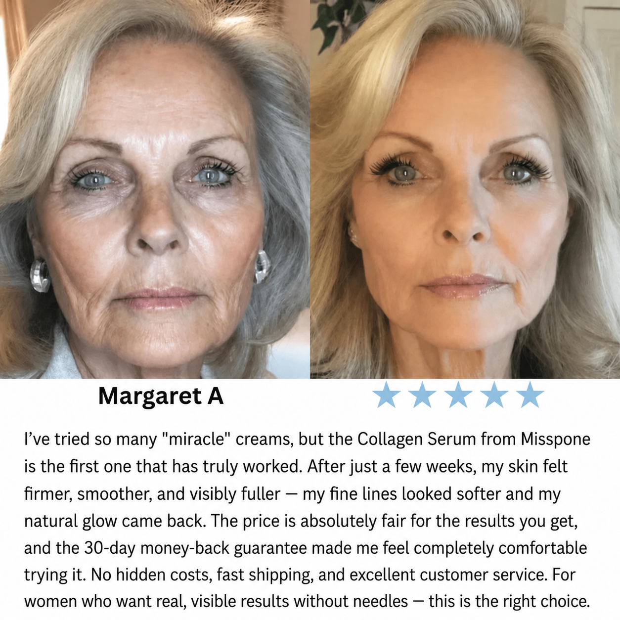 🔥LAST DAY Buy 1 Get 1 Free🔥| Korean Collagen Serum for Mature Skin
